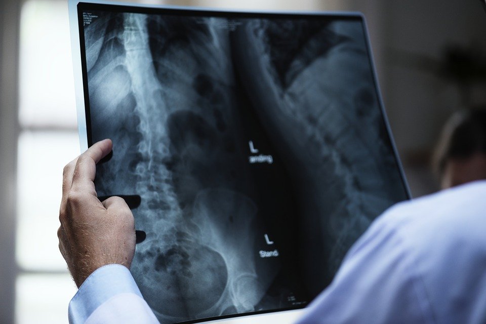 Reasonable Accommodation for Injured Workers Reasonable Accommodation for Injured Workers